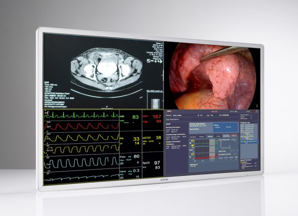 Moniteur Médical BARCO MDSC-8255 – Image 4